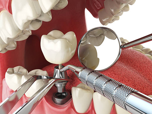 Best After-Hours Emergency Dentist in Oak Brook, IL